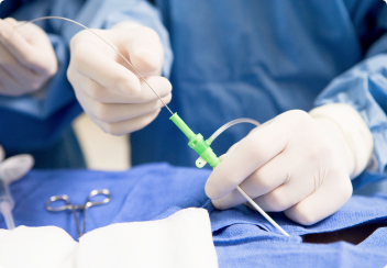 РАК ТОЛЬСТО КИШКИ